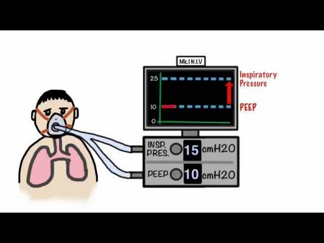 CPAP and Non-Invasive Ventilation in 5 minutes