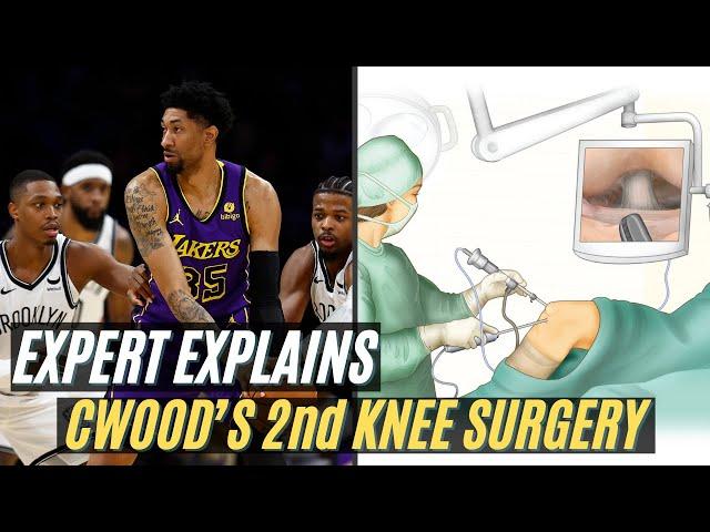 Expert Explains Lakers Christian Wood 2nd Knee Surgery | How Worrying?