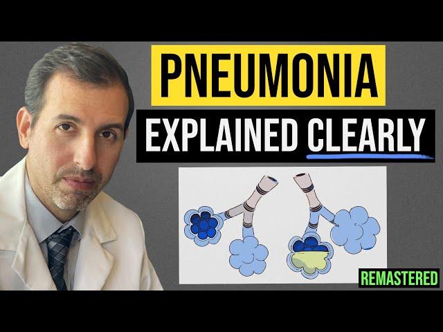 Pneumonia Explained! Symptoms, Diagnosis, Labs, Treatment