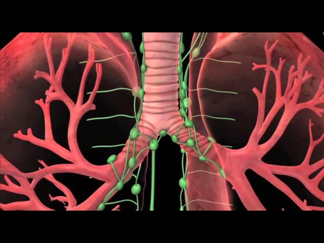 Florida Hospital Cancer Institute-Kissimmee: Dr. David Robinson on Lung Cancer Treatment