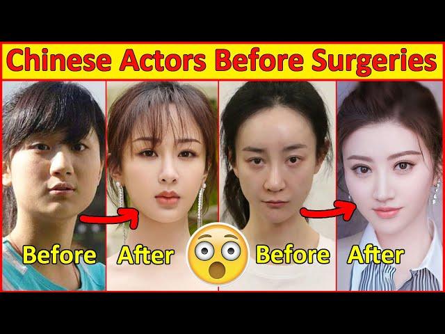 Chinese Actors Before and After Plastic Surgeries  , Incredible Changes, Chinese Drama