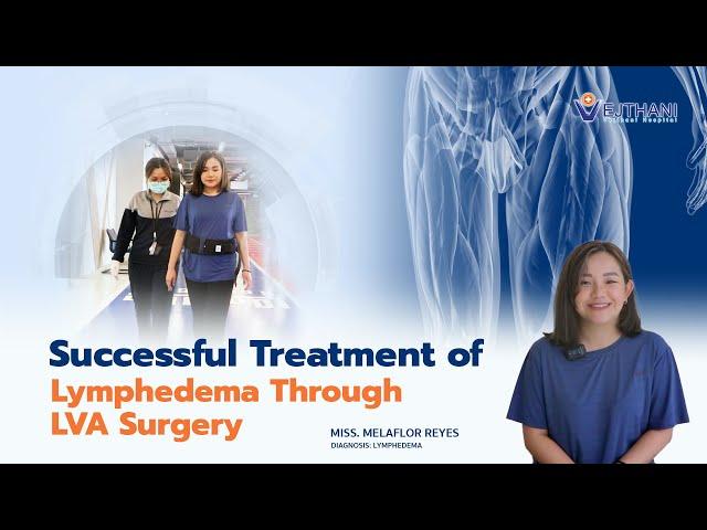 Patient's Story: Successful Treatment of Lymphedema Through LVA Surgery | Part 1