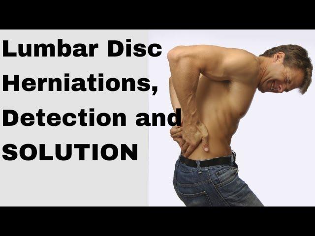 How to fix a herniated disc in the lumbar spine