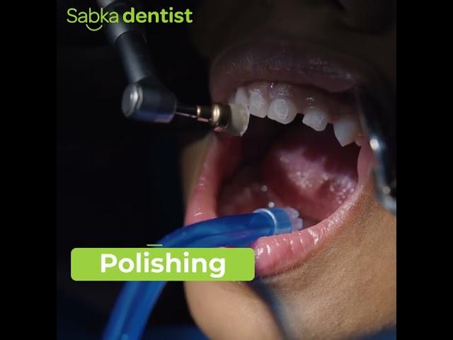 Professional Teeth Cleaning & Polishing by Sabka Dentist Experts