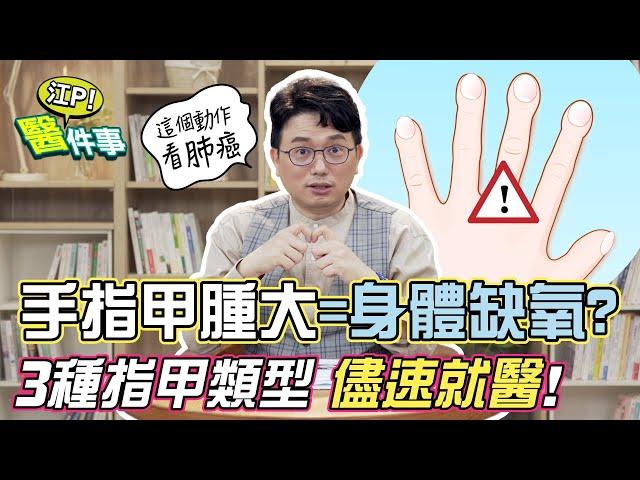 指甲能看出癌症訊息？ 指甲腫大 是 身體缺氧 ？這3種指甲恐罹癌 請盡速就醫！【 江P醫件事 136】 江坤俊醫師