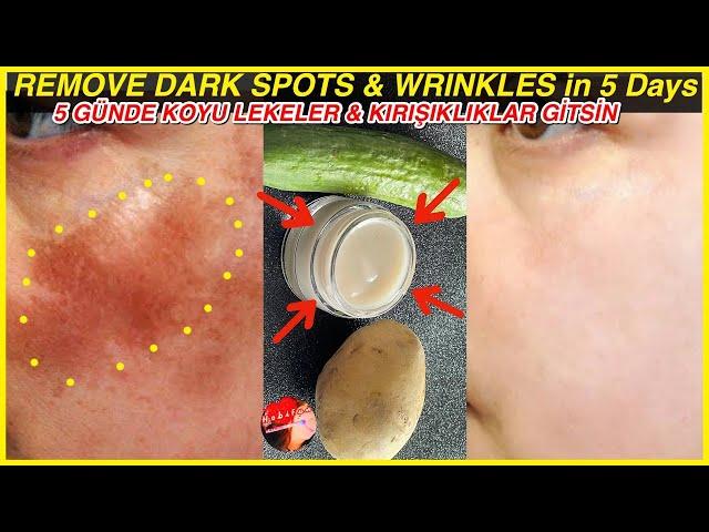 With Potato - Cucumber Face Cream, I Removed DARK CIRCLES - WRINKLES in 5 Days! Skin Whitening