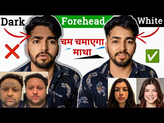 Black Forehead Treatment | Black Forehead to White Forehead | Sahil Nagpal