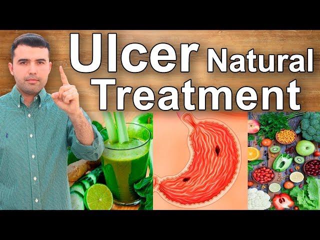 How to Cure Gastric Ulcers Caused by Gastritis - Home Remedies, Juices and Supplements for Ulcers