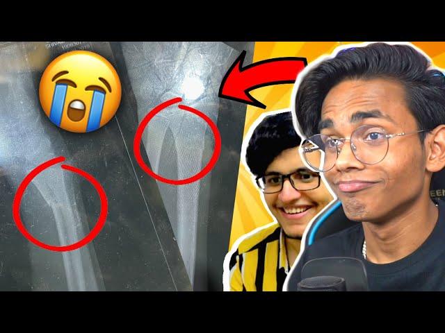 I BROKE MY ARM (STORYTIME) FT. @triggeredinsaan