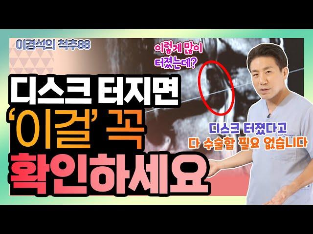 디스크 터졌다고 다 수술하는 건 아니다? - 이경석의 척추88 #98 - 디스크 파열 치료