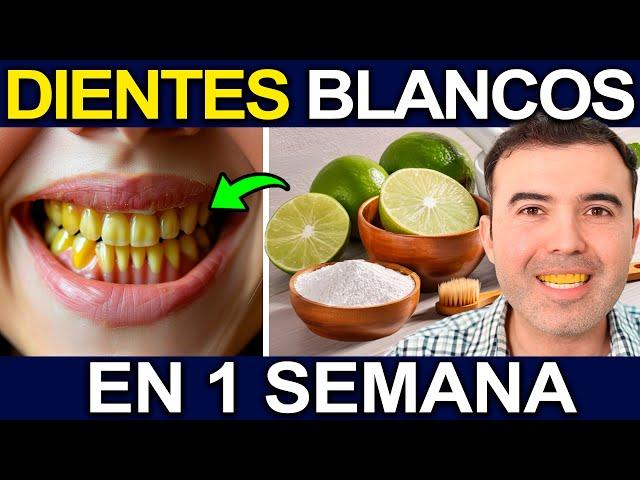 ALERTA! DIENTES AMARILLOS - Como Blanquear Los Dientes En Casa Para Que No Tener Mal Aliento