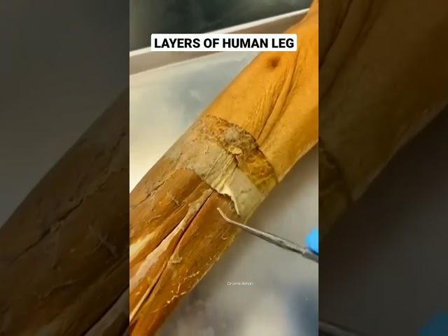 Layers of Leg#physicaltherapy #anatomy_physiology #legpain #movement #innovation #anatomy