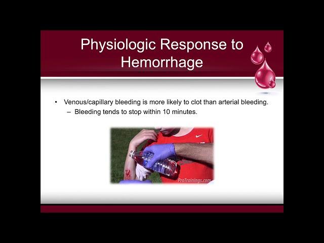 Internal & External Bleeding