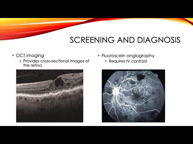 Vision Loss and Diabetic Retinopathy