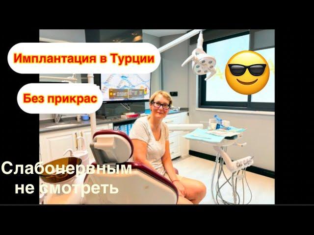 #имплантациязубов Поставили 9 зубных имплантов в Турции. Подробный отчет за 4 дня после Имплантация