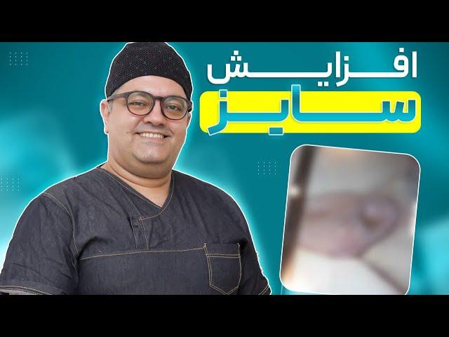 افزایش سایز