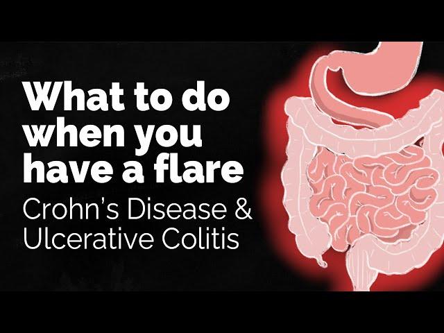 What to do if you have a Crohn's disease or ulcerative colitis flare | GI Society