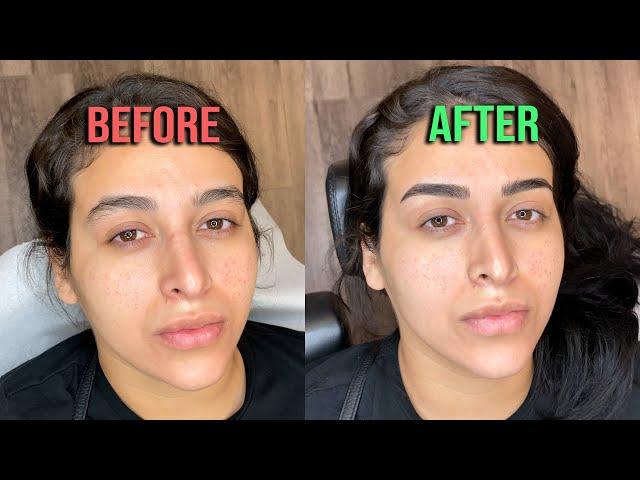 Thick Eyebrow Microblading - Episode 49