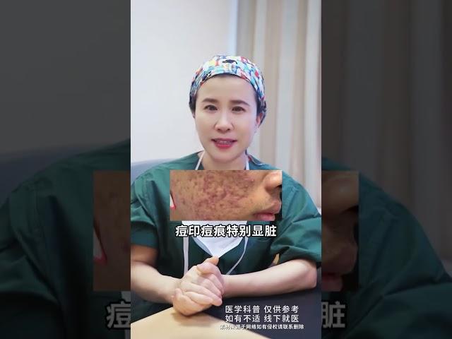对付疤痕，80%的人都做错了#疤痕 #去疤 #关爱女性健康 #硬核健康科普行动  #疤痕凝胶