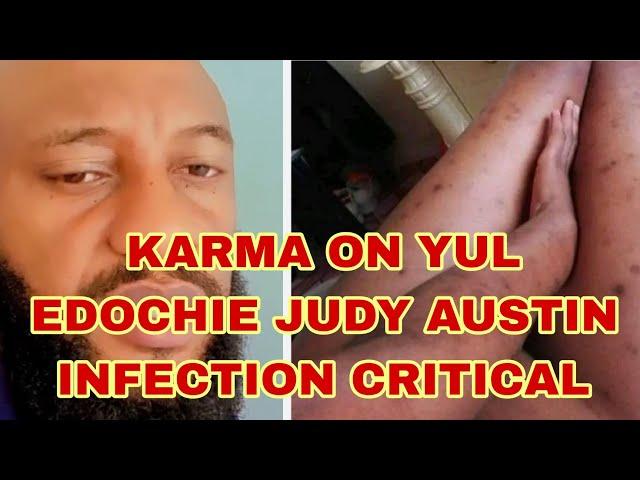 KARMA ON YUL EDOCHIE JUDY AUSTIN INFECTION CRITICAL