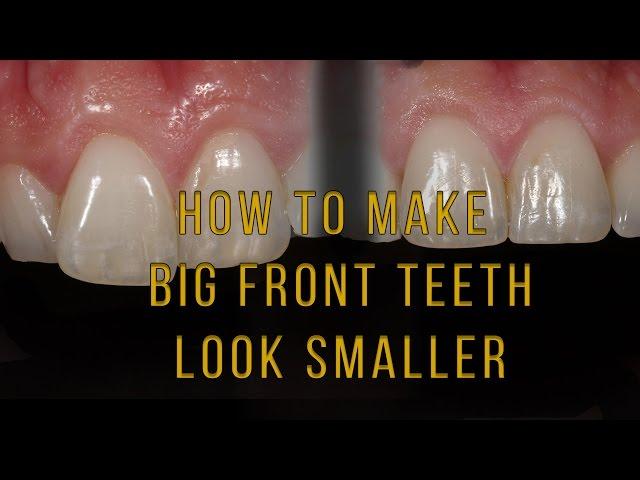 What to do if one tooth looks big and long