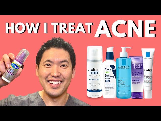 How I Treat Acne: An Overview of Treatment Options