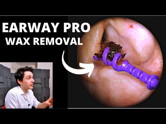 EARWAY PRO Ear Wax Extraction