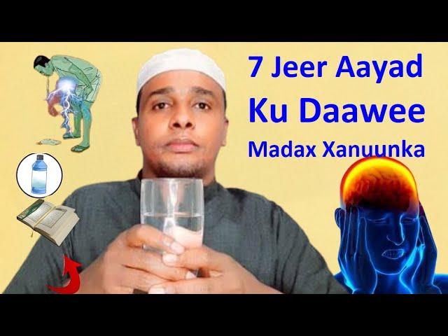 Madax Xanuunka Daqiiqado uga Takhalus 7 jeer Ku Daawee Biyo iyo Qur'aan Fajiciso Cudurka jirkaada