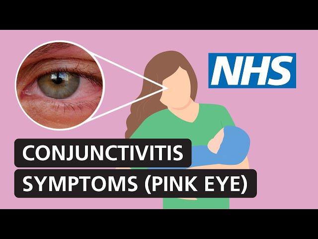 Conjunctivitis: symptoms and treatment for red, itchy, watery eyes | NHS