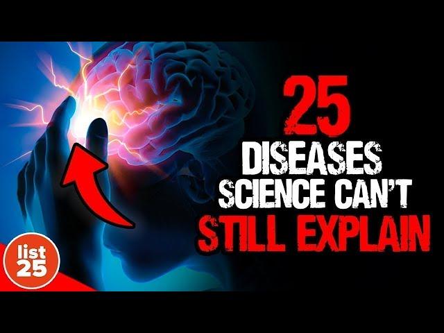 25 Mind Boggling Diseases That Science Can't Explain