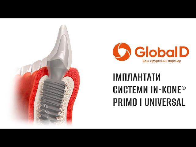 Система імплантатів In-Kone® компанії Global D