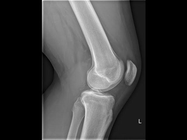 RADS.130 Anatomy of The Lower Leg, Knee and Femur