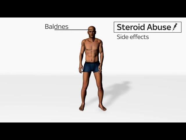Side Effects of Steroids Abuse