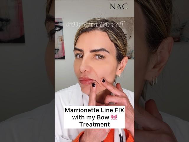 #marionettelines #marionettelinesfiller #fillertraining #drbitafarrell