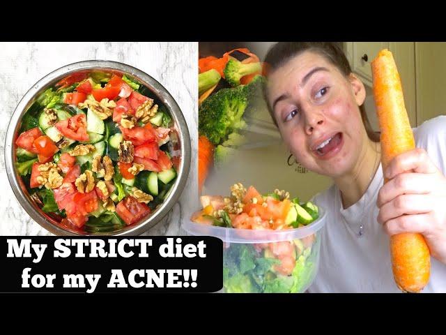 EXACTLY WHAT I EAT IN A DAY ON MY STRICT ANTI ACNE DIET MY NATUROPATH GAVE ME! HOW TO GET CLEAR SKIN