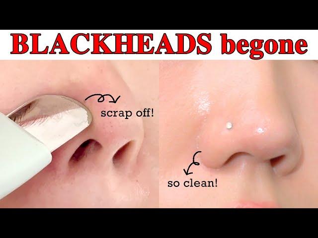 How do I manage my nose so smooth and clean? So SIMPLE Blackhead care 