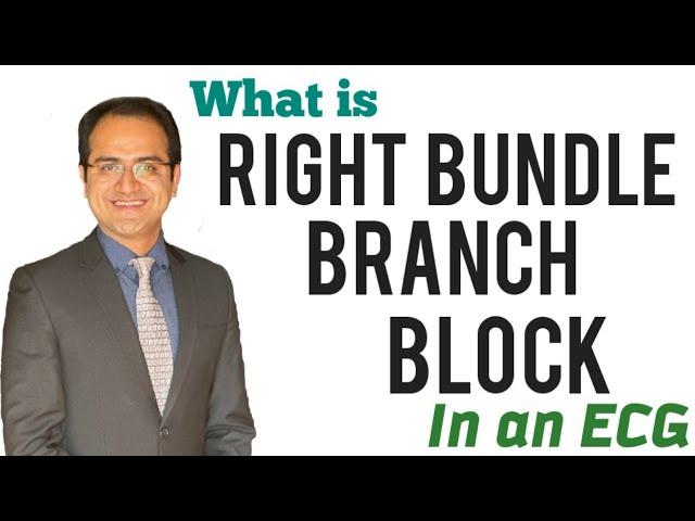 Right Bundle Branch Block (RBBB) ECG Interpretation Explained, How to identify RBBB Block,USMLE NEET