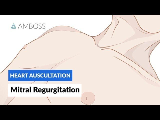 Mitral Regurgitation (MR) - Heart Auscultation - Episode 4