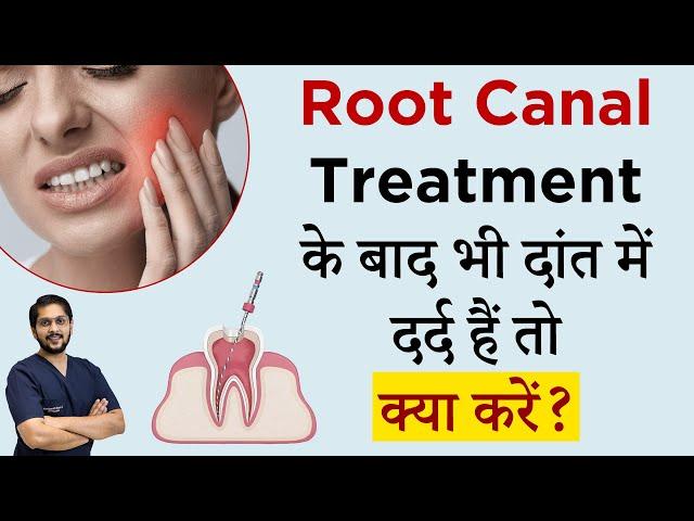 Root Canal Treatment के बाद भी दांत में दर्द है तो क्या करें? | Dr Ankit | Seraphic Dental | Indore