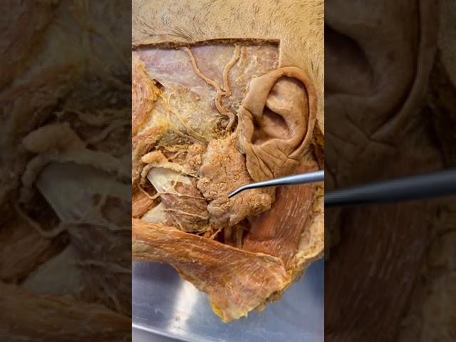 The Inside of a Real Cheek