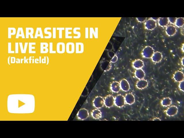 Parasites in Live Blood - Darkfield