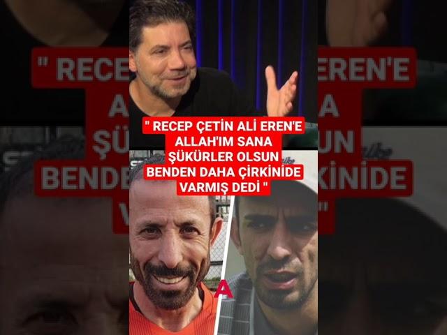 Recep Çetin Allah'ım sana şükürler olsun benden daha çirkinide varmış dedi 