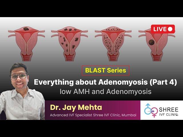 BLAST Series: Everything about Adenomyosis (Part 4) | low AMH and Adenomyosis | Dr Jay Mehta