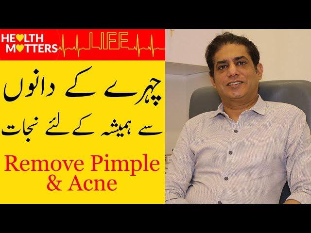 How To Remove Pimples Overnight | Acne Treatment | Dr Kamran Qureshi