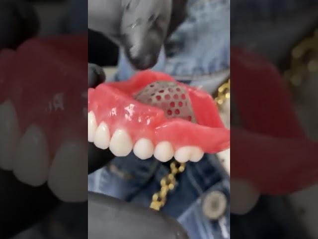 One Day Smile Transformation