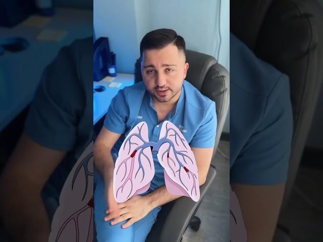Длительные статичные нагрузки еще и в неудобной позе не физиологичны для человека #тромб #медицина