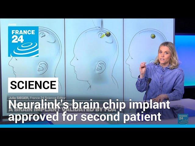 US FDA approves Neuralink's brain chip implant for second patient • FRANCE 24 English