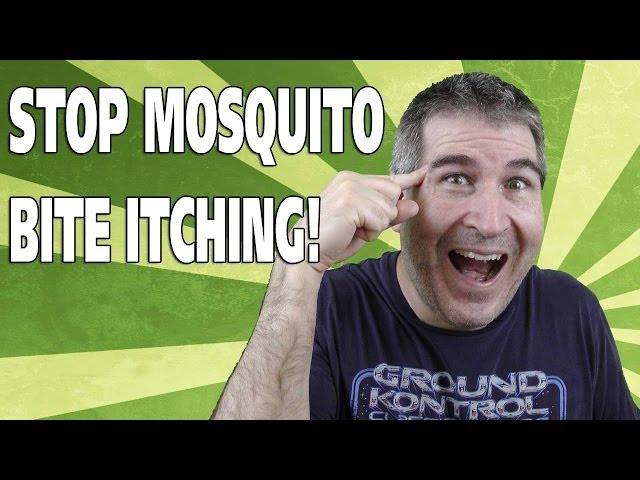 STOP MOSQUITO BITES FROM ITCHING - Easy Everyday Solutions