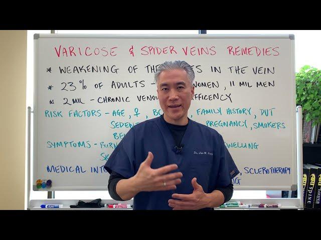 Varicose and Spider Veins----Remedies