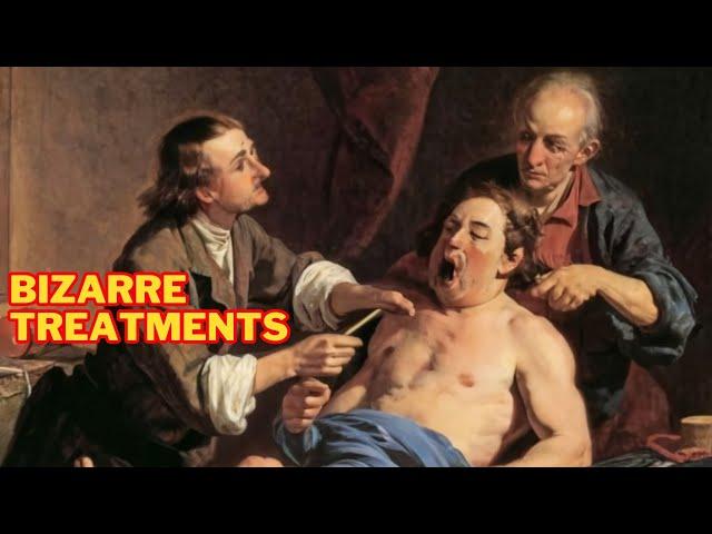 10 Strange Medical Practices from History | Bizarre Treatments